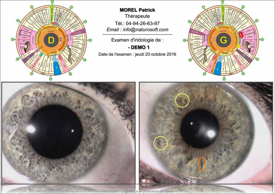 IRIDOLOGIE